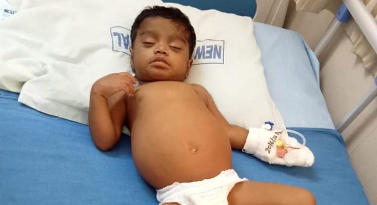 न्यू एरा हॉस्पिटल में हुआ 10 महीने के बच्चे का सफल लिवर प्रत्यारोपण